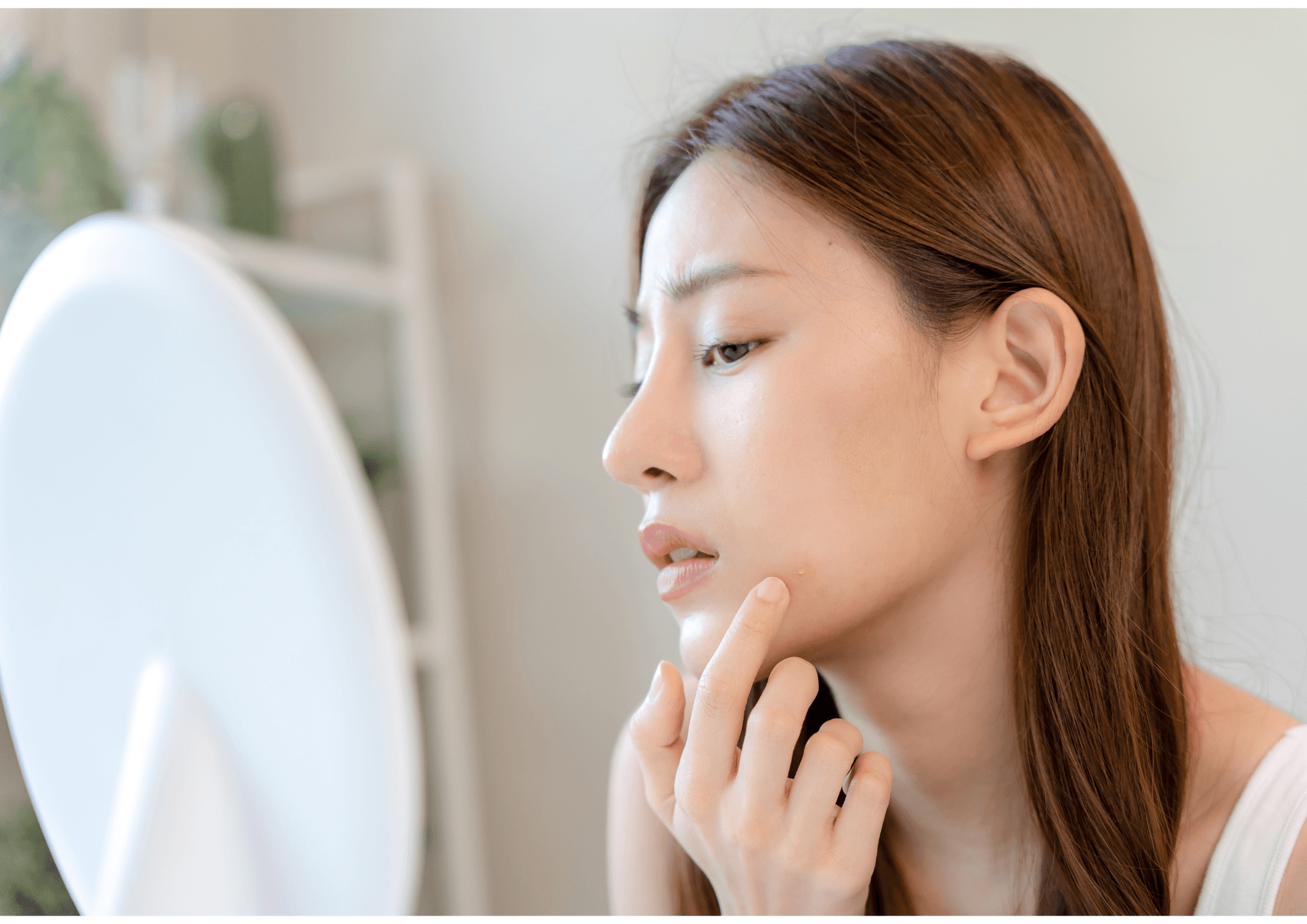 ニキビにおすすめの漢方薬3選